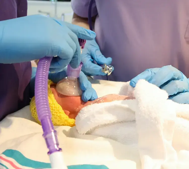 A neonate receiving  respiratory care by two neonatal nurses